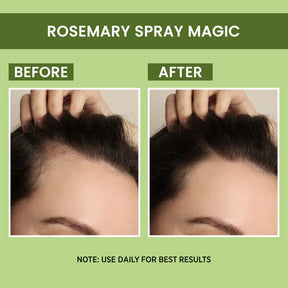 Rosemary Water, Hair Spray For Regrowth 🔥 Buy 1 Get 2 Free🔥